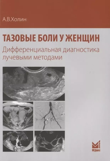 Тазовые боли у женщин Дифференциальная диагностика лучевыми методами (м) Холин: купить с доставкой по Кипру или в книжных магазинах Букберри в Лимасоле, Ларнаке и Пафосе