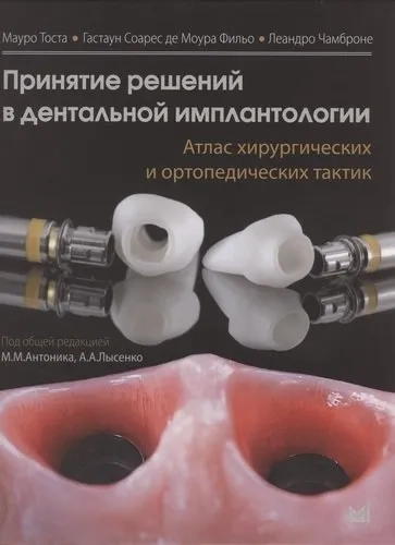 Принятие решений в дентальной имплантологии. Атлас хирургических и ортопедических тактик: купить с доставкой по Кипру или в книжных магазинах Букберри в Лимасоле, Ларнаке и Пафосе