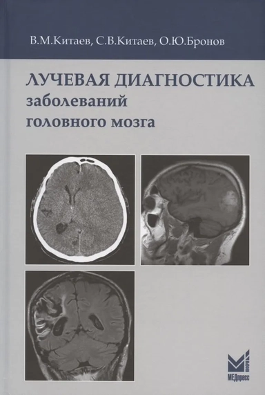 Лучевая диагностика заболеваний головного мозга. 3-е издание: купить с доставкой по Кипру или в книжных магазинах Букберри в Лимасоле, Ларнаке и Пафосе