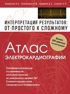 Атлас электрокардиографии. Интерпретация результатов: от простого к сложному: купить с доставкой по Кипру или в книжных магазинах Букберри в Лимасоле, Ларнаке и Пафосе