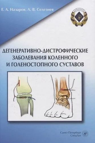 Дегенеративно-дистрофические заболевания коленного и голеностопного суставов: купить с доставкой по Кипру или в книжных магазинах Букберри в Лимасоле, Ларнаке и Пафосе