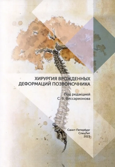 Хирургия врожденных деформаций позвоночника: купить с доставкой по Кипру или в книжных магазинах Букберри в Лимасоле, Ларнаке и Пафосе