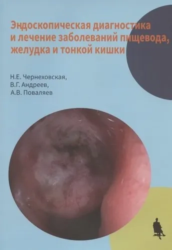 Эндоскопическая диагностика  лечение заболеваний пищевода, желудка и тонкой кишки: купить с доставкой по Кипру или в книжных магазинах Букберри в Лимасоле, Ларнаке и Пафосе