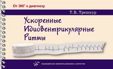 Ускоренные идиовентрикулярные ритмы: купить с доставкой по Кипру или в книжных магазинах Букберри в Лимасоле, Ларнаке и Пафосе