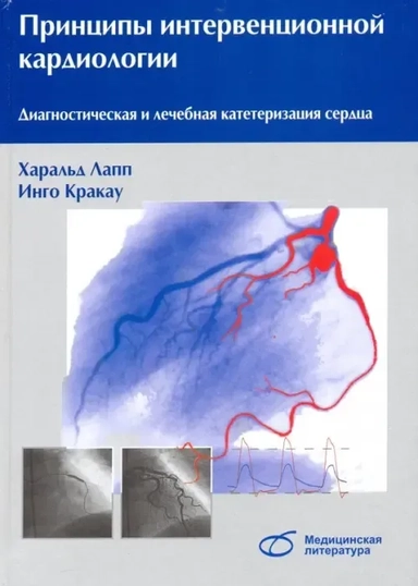 Принципы интервенционной кардиологии. Диагностическая и лечебная катетеризация сердца: купить с доставкой по Кипру или в книжных магазинах Букберри в Лимасоле, Ларнаке и Пафосе