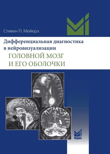 Дифференциальная диагностика в нейровизуализации. Головной мозг и его оболочки: купить с доставкой по Кипру или в книжных магазинах Букберри в Лимасоле, Ларнаке и Пафосе
