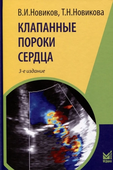 Клапанные пороки сердца: купить с доставкой по Кипру или в книжных магазинах Букберри в Лимасоле, Ларнаке и Пафосе