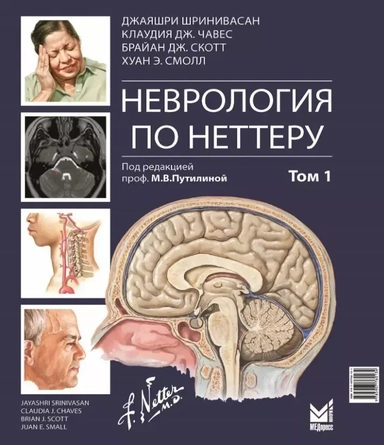 Неврология по Неттеру. Том 1: купить с доставкой по Кипру или в книжных магазинах Букберри в Лимасоле, Ларнаке и Пафосе