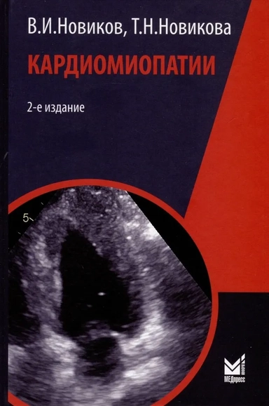 Кардиомиопатии: купить с доставкой по Кипру или в книжных магазинах Букберри в Лимасоле, Ларнаке и Пафосе