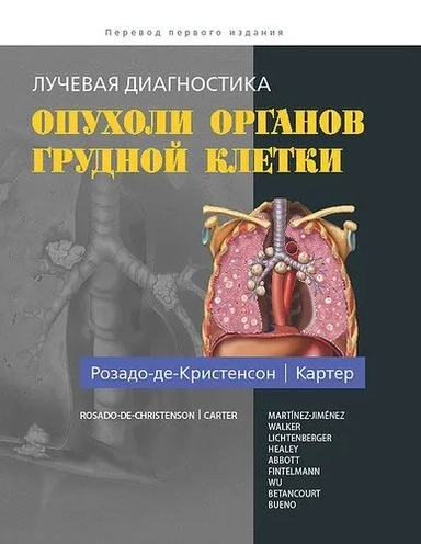 Лучевая диагностика. Опухоли органов грудной клетки: купить с доставкой по Кипру или в книжных магазинах Букберри в Лимасоле, Ларнаке и Пафосе
