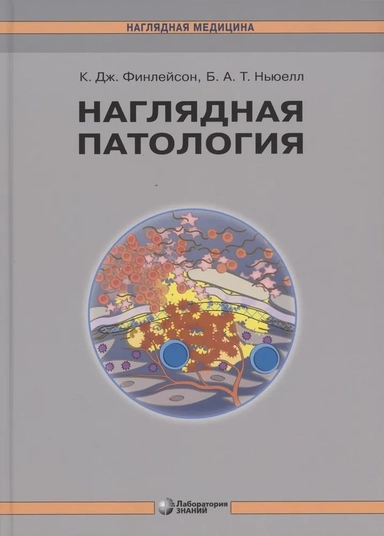 Наглядная патология: купить с доставкой по Кипру или в книжных магазинах Букберри в Лимасоле, Ларнаке и Пафосе