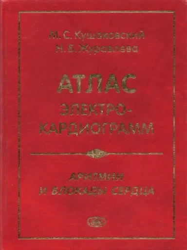 Атлас электрокардиограмм. Аритмии и блокады сердца: купить с доставкой по Кипру или в книжных магазинах Букберри в Лимасоле, Ларнаке и Пафосе