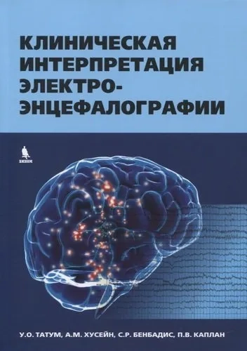 Клиническая интерпретация электроэнцефалографии: купить с доставкой по Кипру или в книжных магазинах Букберри в Лимасоле, Ларнаке и Пафосе