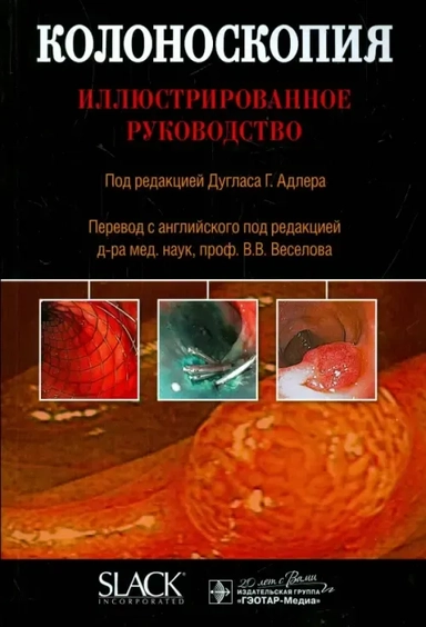 Колоноскопия. Иллюстрированное руководство: купить с доставкой по Кипру или в книжных магазинах Букберри в Лимасоле, Ларнаке и Пафосе