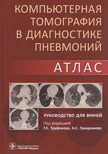 Компьютерная томография в диагностике пневмоний. Атлас: купить с доставкой по Кипру или в книжных магазинах Букберри в Лимасоле, Ларнаке и Пафосе