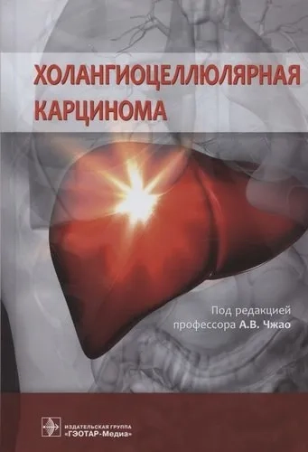 Холангиоцеллюлярная карцинома: купить с доставкой по Кипру или в книжных магазинах Букберри в Лимасоле, Ларнаке и Пафосе