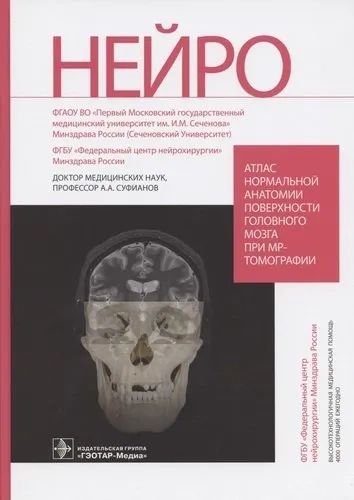 Атлас нормальной анатомии поверхности головного мозга при МР-томографии: купить с доставкой по Кипру или в книжных магазинах Букберри в Лимасоле, Ларнаке и Пафосе
