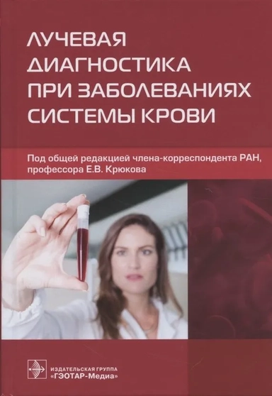 Лучевая диагностика при заболеваниях системы крови: купить с доставкой по Кипру или в книжных магазинах Букберри в Лимасоле, Ларнаке и Пафосе