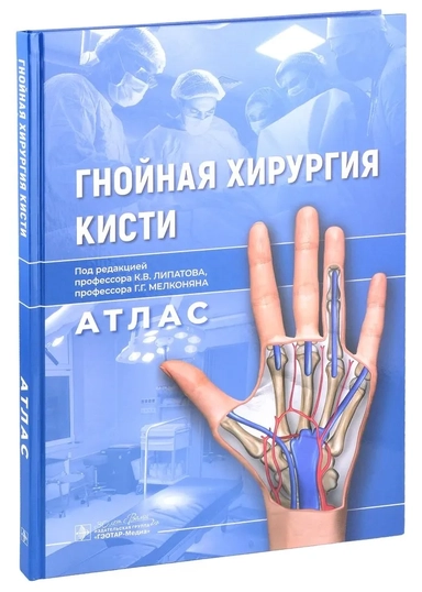Гнойная хирургия кисти. Атлас: купить с доставкой по Кипру или в книжных магазинах Букберри в Лимасоле, Ларнаке и Пафосе