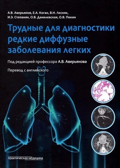 Трудные для диагност.редкие диффузные забол.легких: купить с доставкой по Кипру или в книжных магазинах Букберри в Лимасоле, Ларнаке и Пафосе